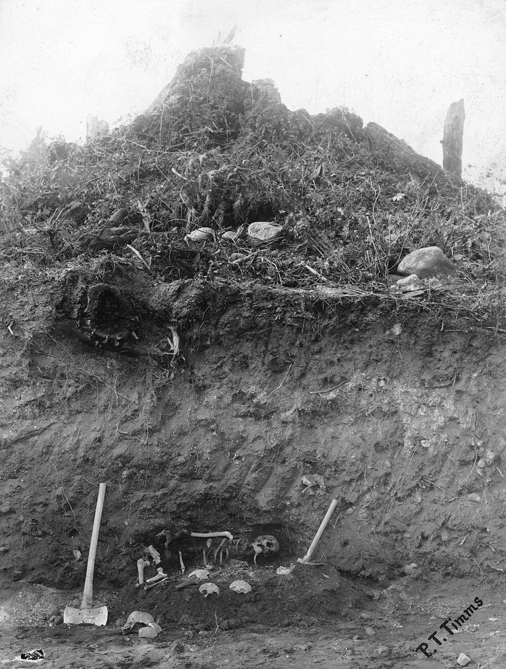 Opgraving van menselijk skelet onder heuvel Archeologische opgraving onthult menselijk skelet en botten onder een heuvel met opgravingsgereedschap in de buurt